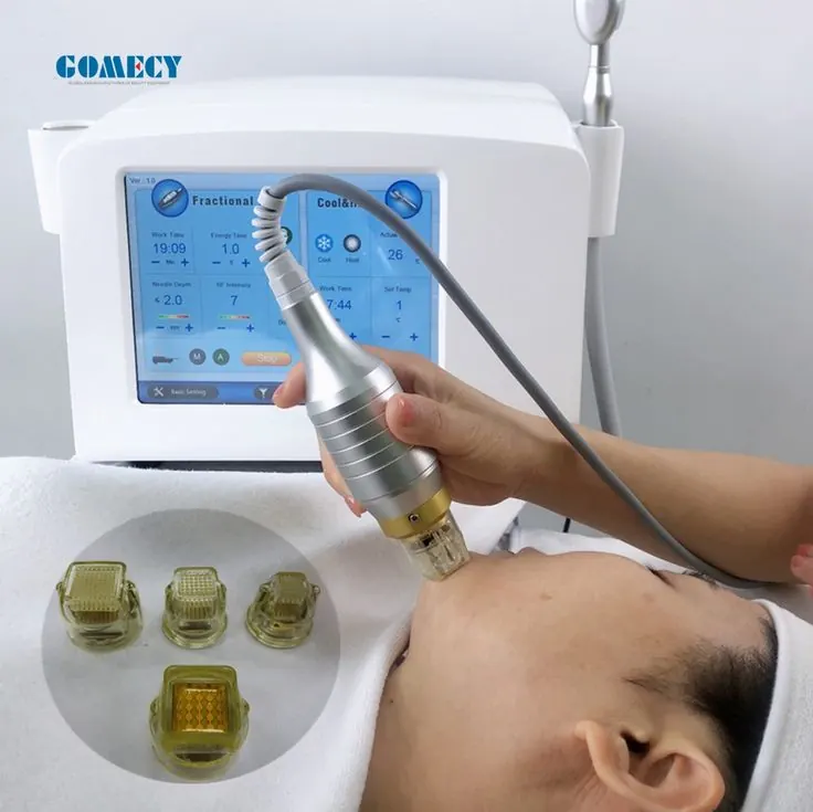 MNRF Therapy
